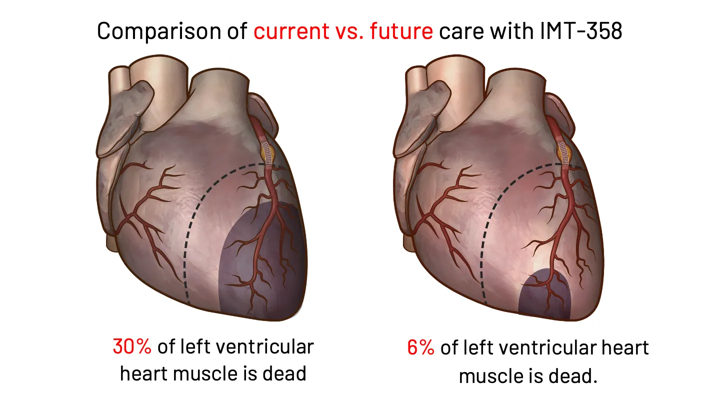 imgi_13_home-heart-slide-desktop-11