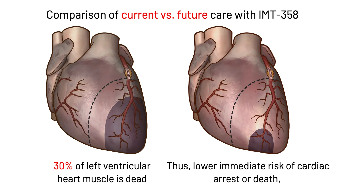 imgi_14_home-heart-slide-desktop-12