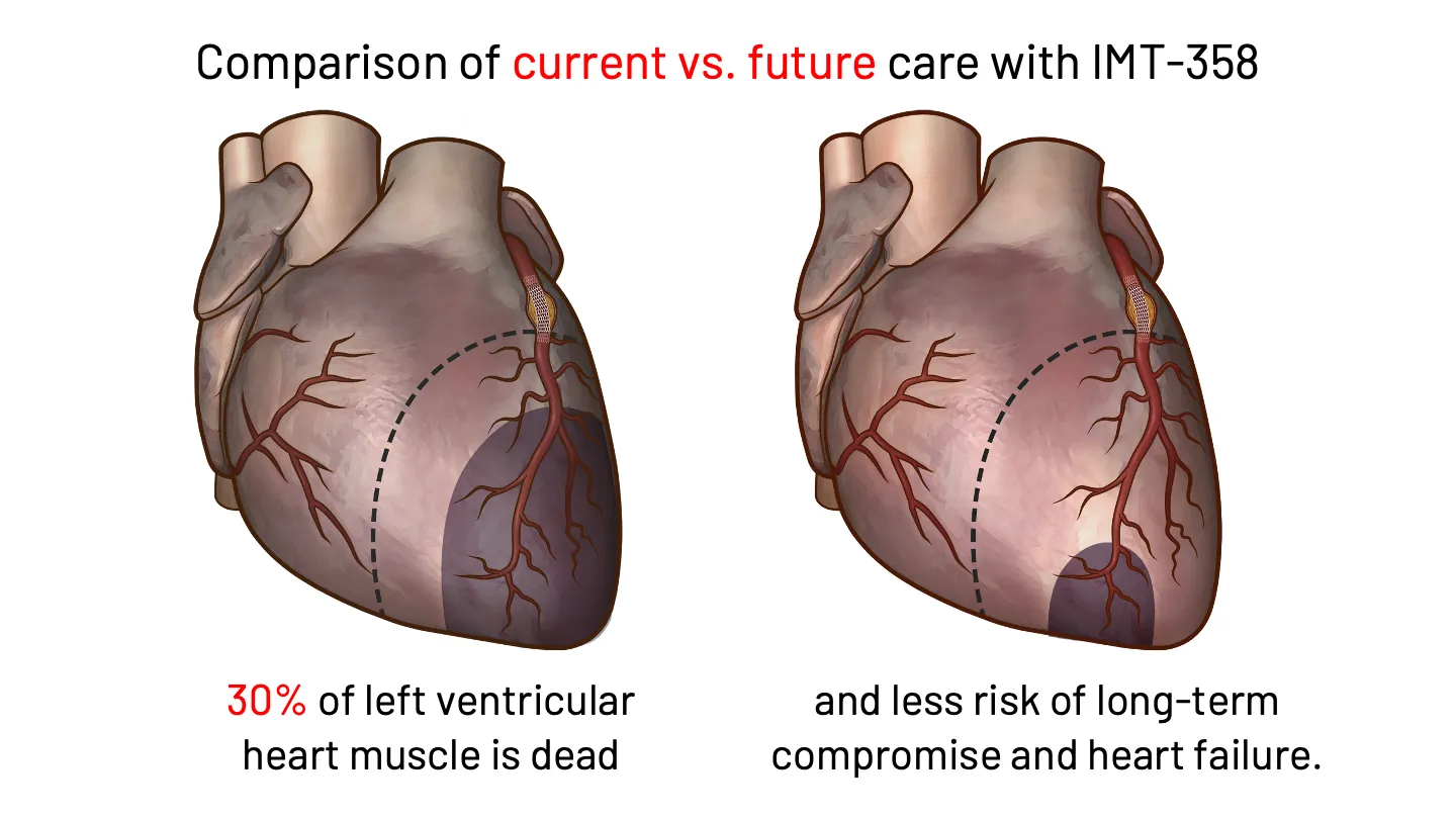 imgi_15_home-heart-slide-desktop-13