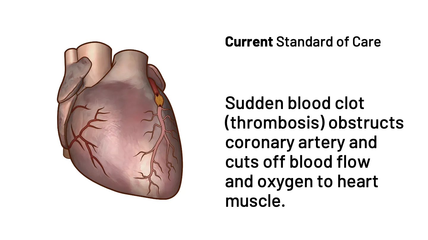 imgi_17_home-heart-slide-mobile-02